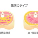 内臓脂肪型肥満の原因と効果的な対処法