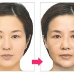 老け顔予防のための10のステップ