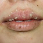 唇の色素沈着・原因・治す方法