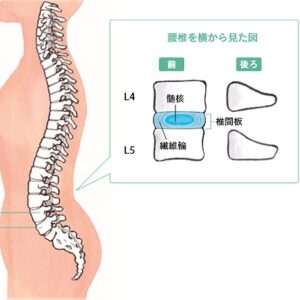 腰痛の原因として知っておきたい5つのポイント